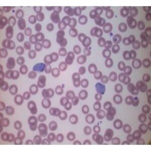 MALARIA PARASITE / BLOOD PARASITE IDENTIFICATION