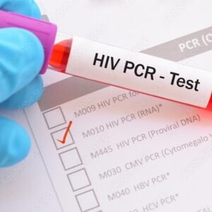HIV 1 & 2 ANTIBODIES SCREENING TEST